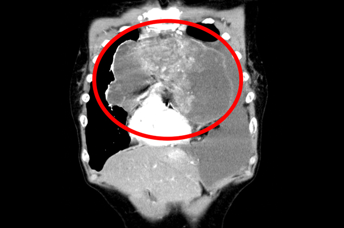 症例1;腫瘍（赤い丸で示した箇所）が肺動脈や大静脈、大動脈と近くに接している症例（60歳男性）