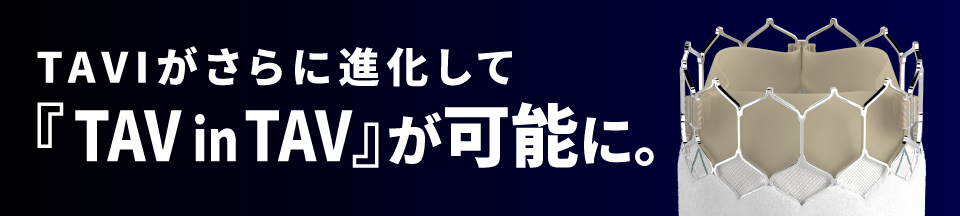 「TAVIがさらに進化して『TAV in TAV』が可能に。当院は、兵庫県で最初の「TAV in TAV 実施施設」に認定されました。」記事配信のご案内