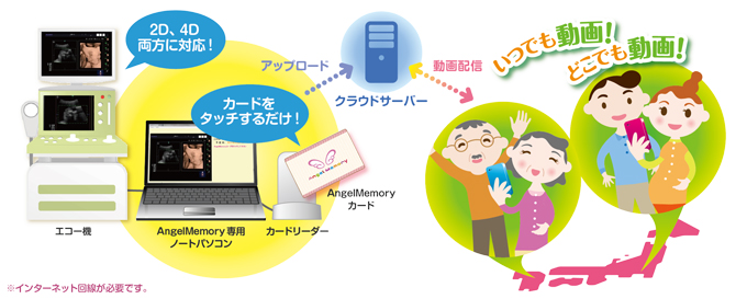 胎児エコー動画配信システムの仕組みを解説する画像