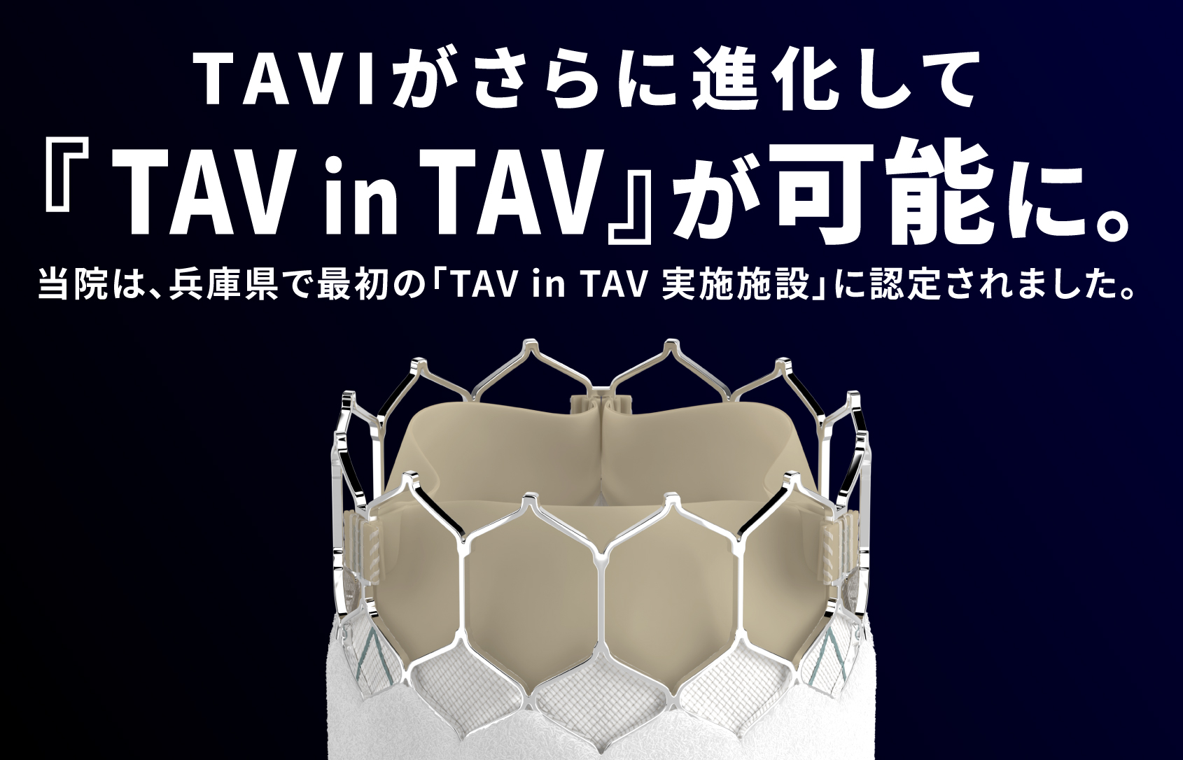 TAVIがさらに進化して『TAV in TAV』が可能に。当院は、兵庫県で最初の「TAV in TAV 実施施設」に認定されました。